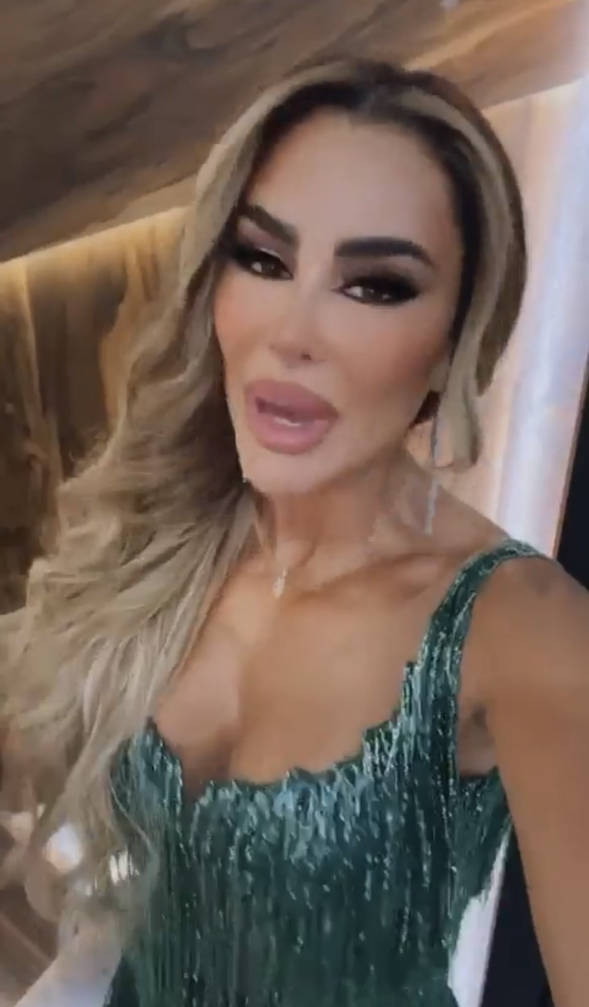Ninel Conde reacciona a comparaciones con Eduin Caz por supuesto exceso de bótox del cantante.