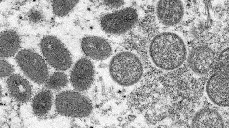 México con casos probables de viruela del mono