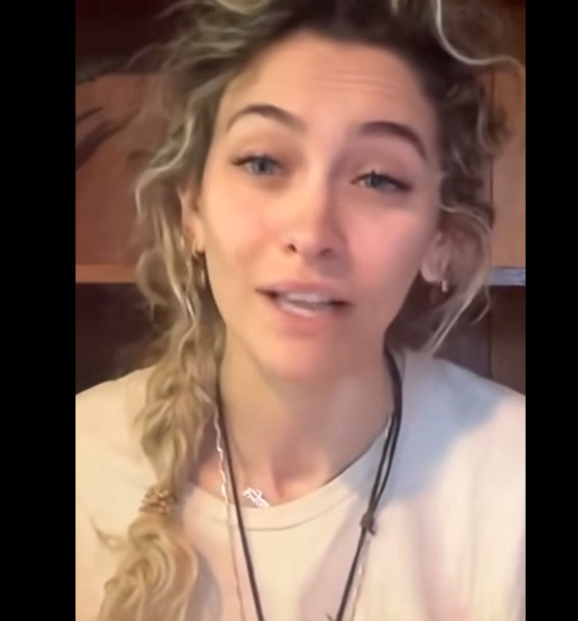 Paris Jackson muestra las duras secuelas de su adicción